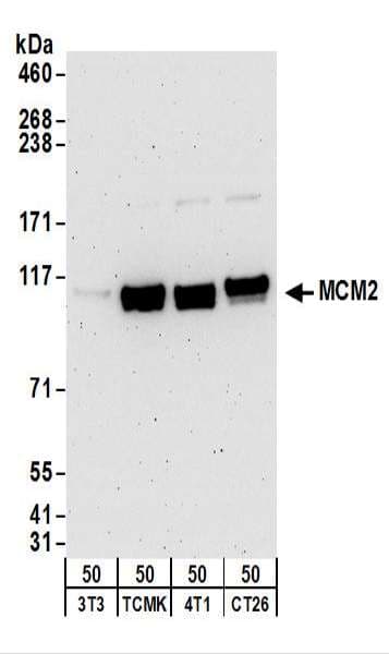 PathPlus™ Polyclonal Rabbit anti-Human MCM2 Antibody (aa1-50, IHC, WB)