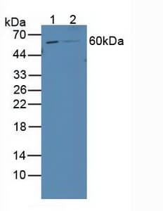 RARB / RAR Beta Antibody (aa205-451, APC)
