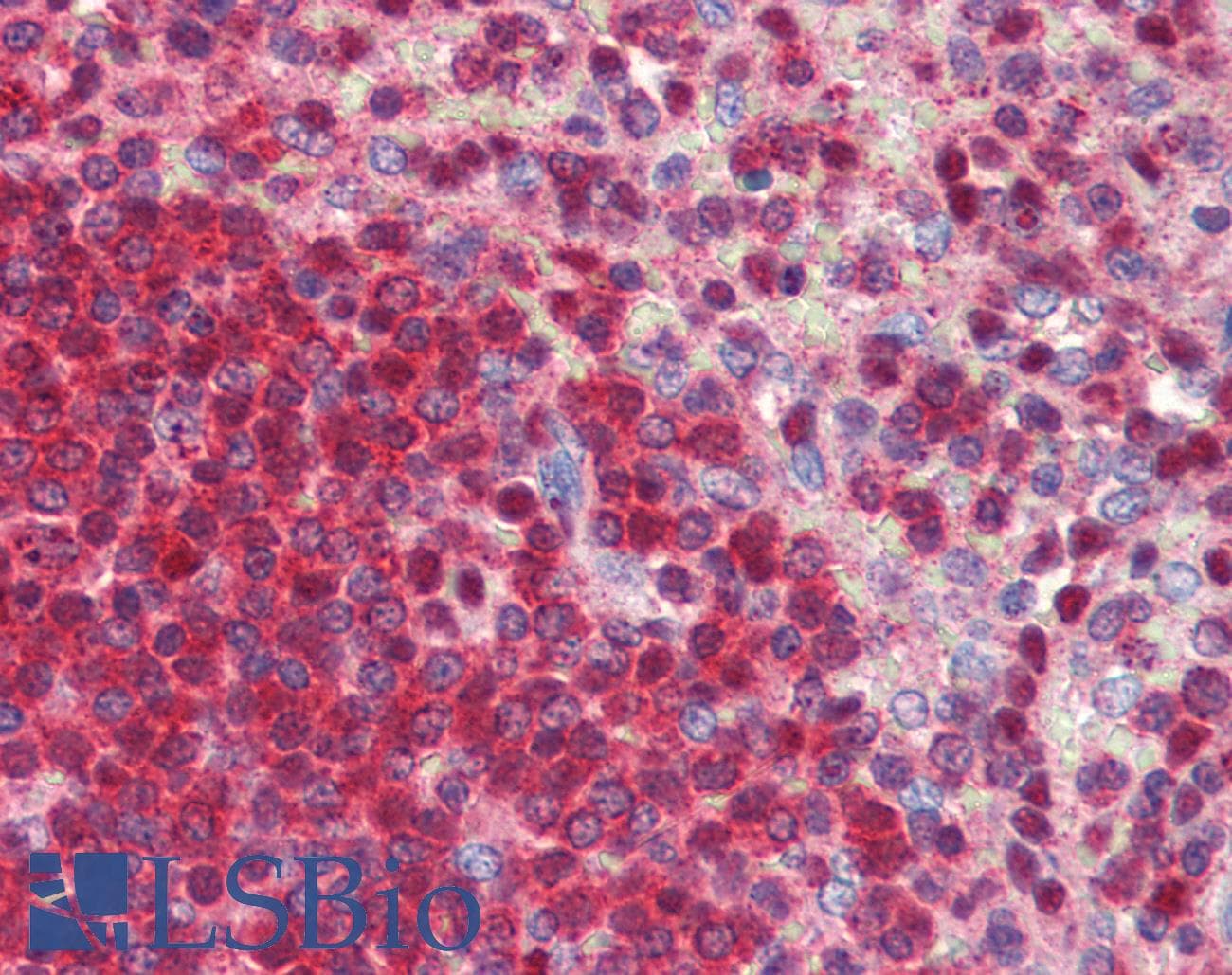 Polyclonal Rabbit anti-Human NR0B2 Antibody (aa110-159, IHC, WB)