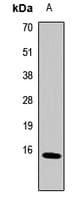 Polyclonal Rabbit anti-Human MT2A / Metallothionein 2A Antibody (IHC, WB)