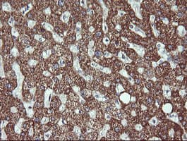 ACAA2 Antibody (clone OTI1B1)