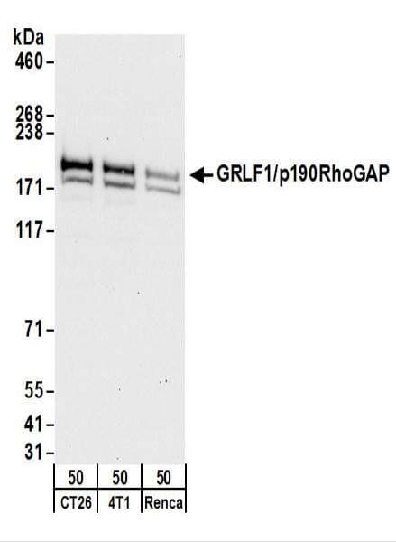 ARHGAP35 / GRLF1 Antibody (aa1200-1250)
