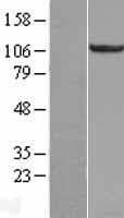 RBM10 Protein (Over-Expression Lysate Myc-DDK (Flag))