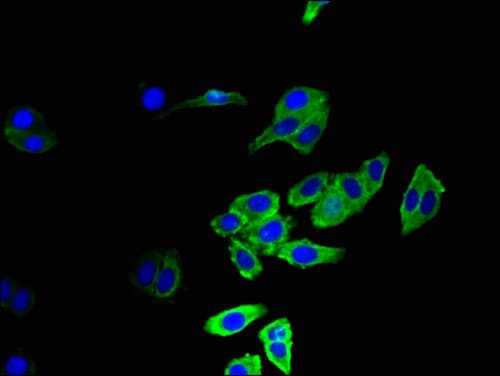 CCR5 Antibody
