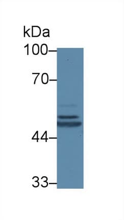 SERPING1 / C1 Inhibitor Antibody (aa148-270)
