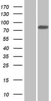 ANKZF1 Protein (Over-Expression Lysate Myc-DDK (Flag))