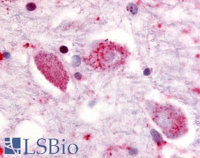 IHC-plus™ SREB / GPR85 Antibody (Cytoplasmic Domain)