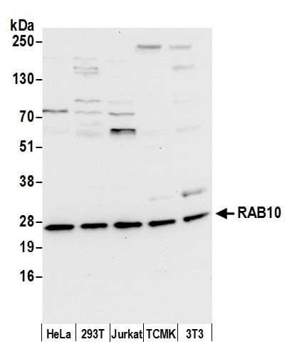 RAB10 Antibody (aa125-175)
