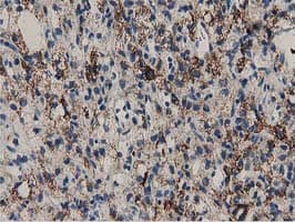 P5CR2 / PYCR2 Antibody (clone OTI5C7)