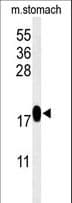 TXNDC12 Antibody (aa144-172)