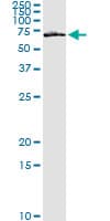 FZD5 / Frizzled 5 Antibody (clone 6A3)