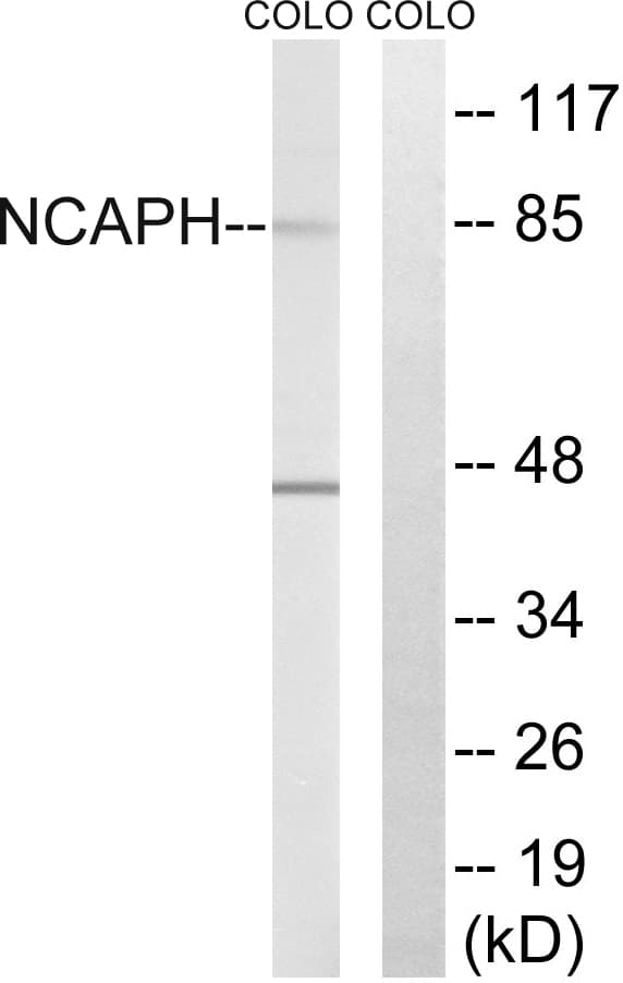 NCAPH / CAP-H Antibody (aa441-490)