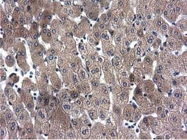 CYB5R3 / B5R Antibody (clone OTI2A10)