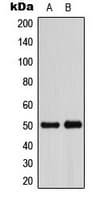 Polyclonal Rabbit anti-Human ADPGK Antibody (Internal, IHC, IF, WB)
