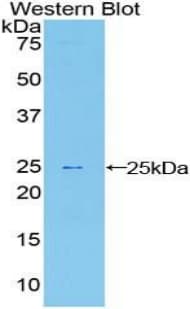 SPRY1 / Sprouty 1 Antibody (aa118-309)