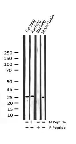 YWHAZ / 14-3-3 Zeta Antibody (phospho-Ser58)