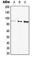 GLB1 / Beta-Galactosidase Antibody (Internal)