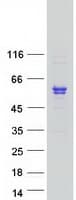 Human SMPDL3B Protein (Recombinant Myc-DDK (Flag))