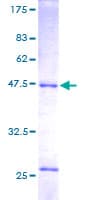 Human RAB14 Protein (Recombinant GST)