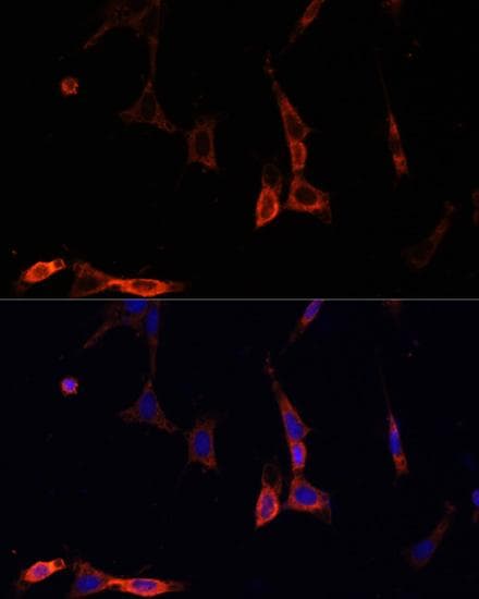 NFKBIA / IKB Alpha / IKBA Antibody