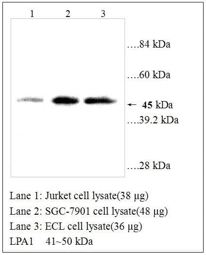 LPAR1 / LPA1 / EDG2 Antibody (aa342-359)