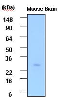 IHC-plus™ Monoclonal Mouse anti-Human PSPH Antibody (clone 3G12, aa1-225, IHC, WB)