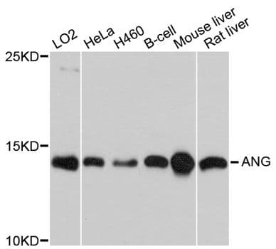 Polyclonal Rabbit anti-Human Angiogenin / ANG Antibody (WB)