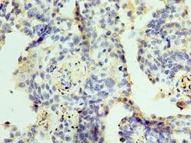 ZMYND10 Antibody (aa201-440)