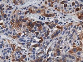 ERIC-1 / TACC3 Antibody (clone OTI3B1)