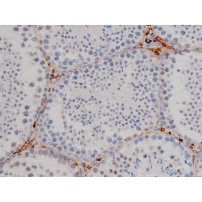 Polyclonal Rabbit anti-Human LYN Antibody (phospho-Tyr508, IHC, IF, WB)