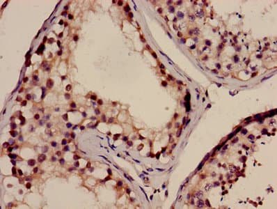 Polyclonal Rabbit anti-Human NELL2 Antibody (IHC)