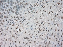 BUB1B / BubR1 Antibody (clone OTI5D9)