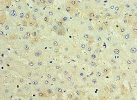 TCTN2 Antibody (aa420-670)