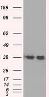 SORD / Sorbitol Dehydrogenase Antibody (clone OTI15H2)