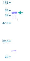 Human SIRT3 / Sirtuin 3 Protein (Recombinant GST)