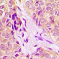 DDX55 Antibody (Internal)