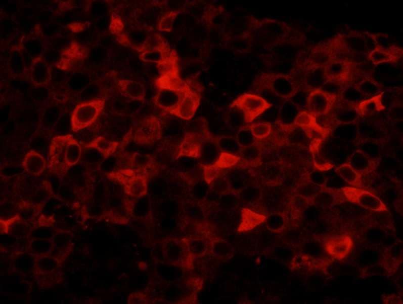 FASN / Fatty Acid Synthase Antibody (aa2462-2511)