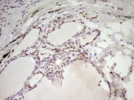 Monoclonal Mouse anti-Human SP110 Antibody (clone OTI4C1, aa232-521, IHC, WB)
