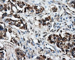 Monoclonal Mouse anti-Human BRAF / B-Raf Antibody (clone OTI1E2, IHC, IF, WB)