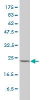 MAD2L1 / MAD2 Antibody (clone 2E2-1D6)