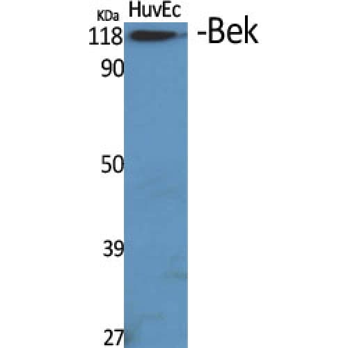 FGFR2 / FGF Receptor 2 Antibody (440-520 aa, Internal)