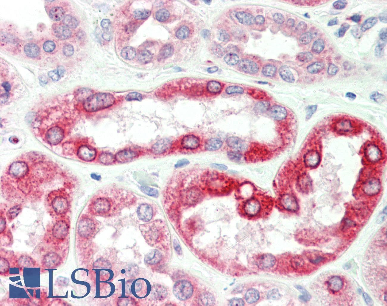SLC37A4 / G6PT Antibody (aa38-87)