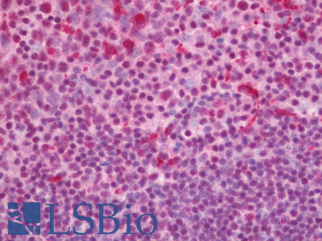 IHC-plus™ PHF8 Antibody (aa650-700)