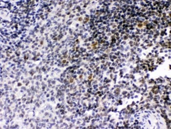 RAG2 / RAG-2 Antibody