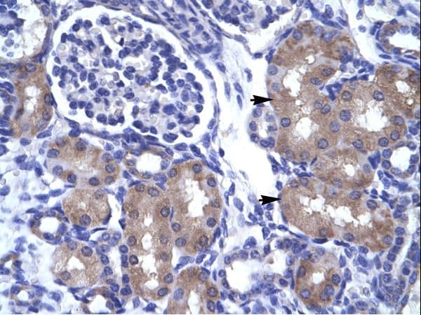 ASCL1 / MASH1 Antibody (aa48-97)