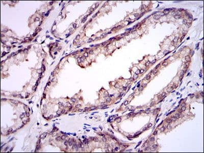 UBE2I / UBC9 Antibody (clone 1B10)