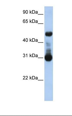 ACVRL1 Antibody (aa38-87)