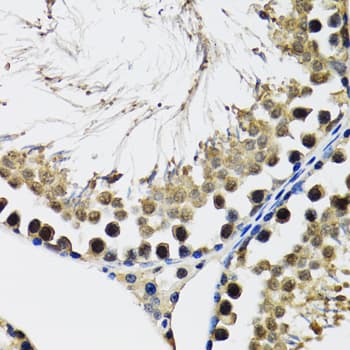 DDX41 / ABS Antibody