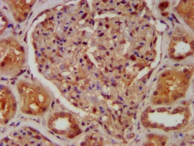 CABP4 Antibody
