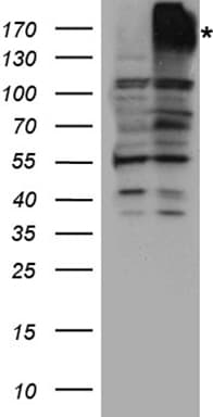 ABCB1 / MDR1 / P Glycoprotein Antibody